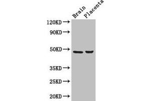 Western Blot Positive WB detected in: Mouse brain tissue, Human placenta tissue All lanes: CD177 antibody at 3 μg/mL Secondary Goat polyclonal to rabbit IgG at 1/50000 dilution Predicted band size: 47, 28, 16 kDa Observed band size: 47 kDa (CD177 抗体  (AA 22-321))