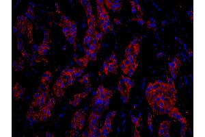 Immunofluorescence (IF) image for anti-Cytoskeleton-Associated Protein 4 (CKAP4) (AA 500-550) antibody (ABIN7448940) (CKAP4 抗体  (AA 500-550))