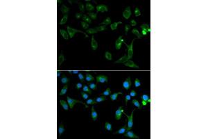 Immunofluorescence analysis of U2OS cells using TOLLIP antibody. (TOLLIP 抗体  (AA 1-274))