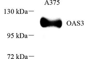 Western blot analysis of OAS3 (ABIN7072846),at dilution of 1: 1000 (OAS3 抗体)