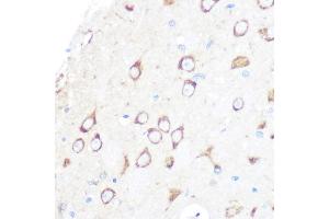 Immunohistochemistry of paraffin-embedded rat brain using MSR1 Rabbit mAb (ABIN7268353) at dilution of 1:100 (40x lens). (Macrophage Scavenger Receptor 1 抗体)