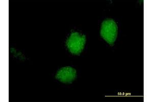 Immunofluorescence of purified MaxPab antibody to RARRES3 on HeLa cell. (RARRES3 抗体  (AA 1-164))