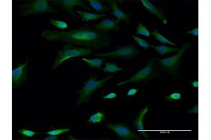 Immunofluorescence of monoclonal antibody to CBLL1 on HeLa cell. (CBLL1 抗体  (AA 1-100))