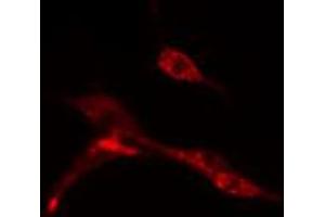 ABIN6274543 staining HeLa cells by IF/ICC. (CNOT7 抗体  (C-Term))