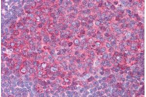 Human Tonsil: Formalin-Fixed, Paraffin-Embedded (FFPE)