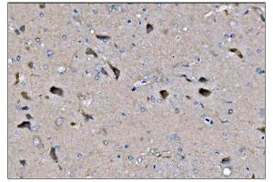 IHC analysis of Dynamin 3/DNM3 using anti-Dynamin 3/DNM3 antibody (ABIN7601163).