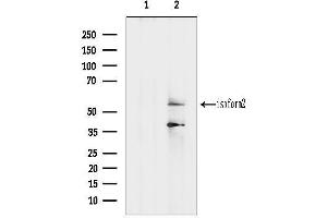 Western blot analysis of lysates from Mouse spleen, using PIP5K1A Antibody.