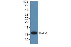 Detection of Recombinant PSCA, Human using Monoclonal Antibody to Prostate Stem Cell Antigen (PSCA) (PSCA 抗体  (AA 22-95))