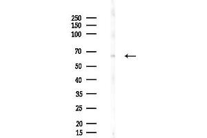 Western blot analysis of lysates from B16F10-LUC cells(starvation 24h treatment), using Phospho-Optineurin (Ser177) Antibody at 1/1000 dilution.