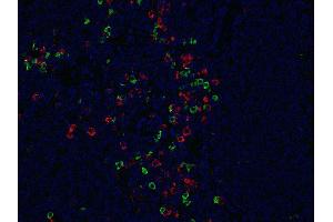 Indirect immunostaining of formalin-fixed paraffin embedded human tonsil section with anti-λ light chain (dilution 1 : 200; green) and mouse anti-κ light chain (cat. (兔 anti-人 IgG lambda (Light Chain) Antibody)