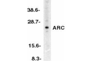 Image no. 1 for anti-Nucleolar Protein 3 (Apoptosis Repressor with CARD Domain) (NOL3) antibody (ABIN203569) (NOL3 抗体)