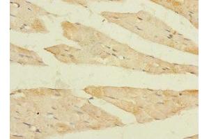 Immunohistochemistry of paraffin-embedded human skeletal muscle tissue using ABIN7152439 at dilution of 1:100 (FBXO4 抗体  (AA 201-500))