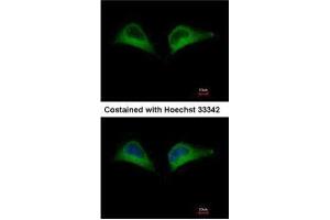 ICC/IF Image Immunofluorescence analysis of methanol-fixed HeLa, using PSMD7, antibody at 1:500 dilution. (PSMD7 抗体)