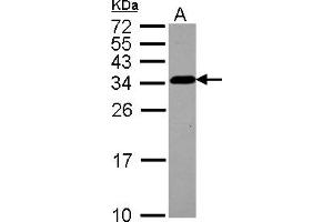 Western Blotting (WB) image for anti-Tubulin Folding Cofactor B (TBCB) (AA 1-219) antibody (ABIN1501321) (TBCB 抗体  (AA 1-219))