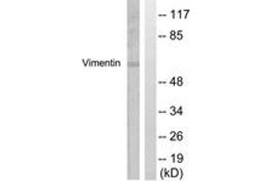Western blot analysis of extracts from A549 cells, treated with Nocodazole 1ug/ml 16h, using Vimentin (Ab-56) Antibody. (Vimentin 抗体  (AA 31-80))