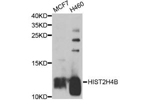 Western blot analysis of extracts of various cell lines, using HIST2H4B antibody (ABIN5974305) at 1/1000 dilution. (Histone Cluster 2, H4b (HIST2H4B) 抗体)