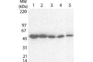Western blot using  Anti-Tetanus Toxin C antibody shows detection of a band at ~52 kDa corresponding to full length 6X His-TTFC fusion protein (arrowhead). (Tetanus Toxin C-Fragment (TTC) 抗体)