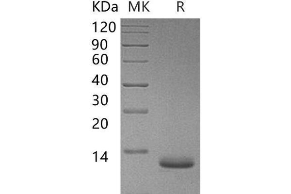 S100A11 Protein (His tag)