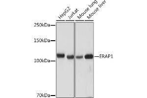 Western blot analysis of extracts of various cell lines, using ER Rabbit mAb (ABIN7266941) at 1:1000 dilution. (ERAP1 抗体)