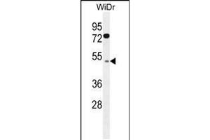 Western blot analysis in WiDr cell line lysates (35ug/lane). (RMD1 抗体  (N-Term))