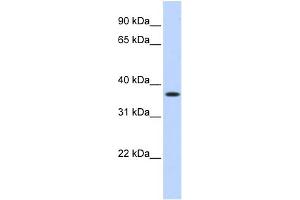 WB Suggested Anti-MTHFD2 Antibody Titration:  0. (MTHFD2 抗体  (Middle Region))