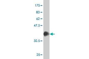 Western Blot detection against Immunogen (37. (SRF 抗体  (AA 406-508))