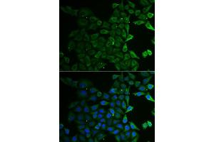 Immunofluorescence analysis of U2OS cells using C21orf33 antibody. (C21orf33 抗体  (AA 42-268))