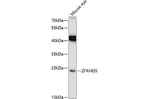 Western blot analysis of extracts of mouse eye, using ZF Antibody (ABIN6130935, ABIN6150428, ABIN6150429 and ABIN6217088) at 1:1000 dilution. (ZFAND5 抗体  (AA 40-150))