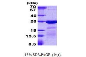 Hematological and Neurological Expressed 1-Like (HN1L) protein (His tag)
