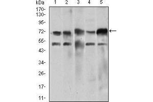 Western Blotting (WB) image for anti-Wolf-Hirschhorn Syndrome Candidate 2 (WHSC2) (AA 280-511) antibody (ABIN1724801)