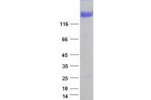 Western Blotting (WB) image for Neurofascin (NFASC) (Transcript Variant 1) protein (Myc-DYKDDDDK Tag) (ABIN2727125)