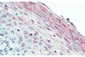 Detection of UCN2 in Human Tonsil Tissue using Polyclonal Antibody to Urocortin 2 (UCN2) (Urocortin 2 抗体  (AA 23-107))