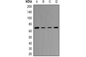 Western blot analysis of Transketolase expression in Jurkat (A), MCF7 (B), mouse liver (C), rat kidney (D) whole cell lysates. (TKT 抗体)