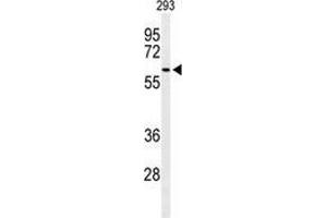Western blot analysis of SNX27 (arrow) in 293 cell line lysates (35ug/lane) using Sorting nexin-27 (SNX27)