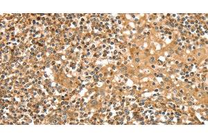 Immunohistochemistry of paraffin-embedded Human tonsil tissue using SLC8A3 Polyclonal Antibody at dilution 1:35 (SLC8A3 抗体)