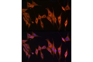 Immunofluorescence (IF) image for anti-Thymidine Kinase 1, Soluble (TK1) (AA 1-234) antibody (ABIN6149198)