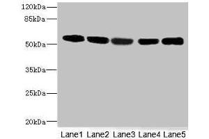 Western blot All lanes: FRKantibody at 3. (FRK 抗体  (AA 1-220))