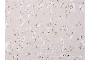 Immunoperoxidase of monoclonal antibody to ALPK3 on formalin-fixed paraffin-embedded human cerebral cortex. (ALPK3 抗体  (AA 1811-1906))