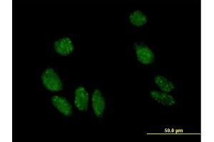 Immunofluorescence of purified MaxPab antibody to MYL5 on HeLa cell. (MYL5 抗体  (AA 1-173))