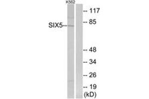 Western blot analysis of extracts from K562 cells, using SIX5 Antibody. (Six5 抗体  (AA 201-250))