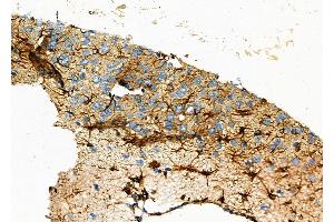 ABIN6257365 and ABIN6273845 at 1/100 staining Rat brain tissue by IHC-P. (OR51A1P 抗体)