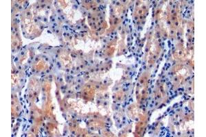 Detection of MCP1 in Rabbit Kidney Tissue using Monoclonal Antibody to Monocyte Chemotactic Protein 1 (MCP1) (CCL2 抗体  (AA 24-125))