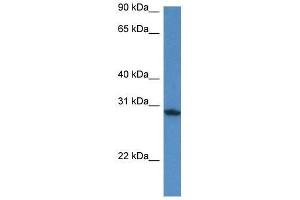 Western Blot showing Fam168a antibody used at a concentration of 1. (FAM168A 抗体  (N-Term))