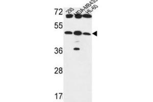 Western Blotting (WB) image for anti-UDP-GlcNAc:betaGal beta-1,3-N-Acetylglucosaminyltransferase 5 (B3GNT5) antibody (ABIN3004261) (B3GNT5 抗体)