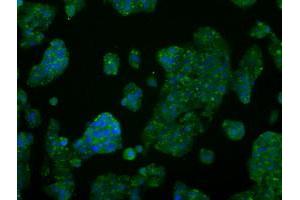 Image no. 6 for anti-V-Akt Murine Thymoma Viral Oncogene Homolog 2 (AKT2) antibody (ABIN1496564) (AKT2 抗体)