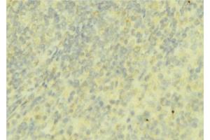 ABIN6276737 at 1/100 staining Mouse liver tissue by IHC-P. (Coagulation Factor IX 抗体  (C-Term))
