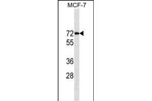 ESR1/ER Antibody (ABIN1539856 and ABIN2843829) western blot analysis in MCF-7 cell line lysates (35 μg/lane). (Estrogen Receptor alpha 抗体  (AA 246-273))