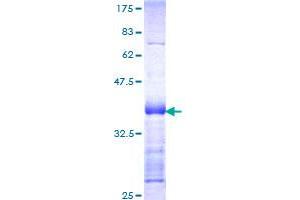 Image no. 1 for serine threonine Kinase 39 (STK39) (AA 362-461) protein (GST tag) (ABIN1321704)