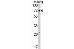 Western Blotting (WB) image for anti-Fragile X Mental Retardation 1 (FMR1) antibody (ABIN3002852)