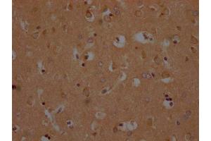 IHC image of ABIN7139952 diluted at 1:200 and staining in paraffin-embedded human brain tissue performed on a Leica BondTM system. (OR1A2 抗体  (AA 247-262))